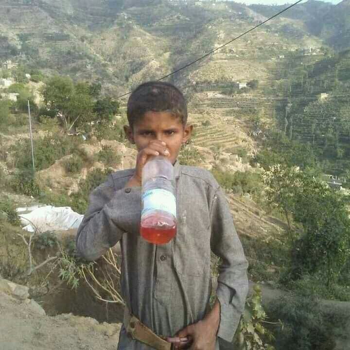 طفل يمني يعيش على الوقود كغذاء له
